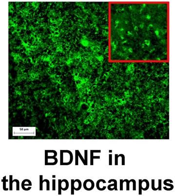 Brain but not serum BDNF levels are associated with structural alterations in the hippocampal regions in patients with drug-resistant mesial temporal lobe epilepsy